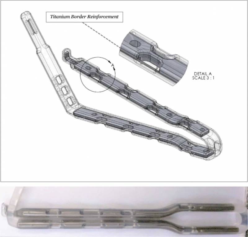 Bariclip clinique de l'obésité à Toulon